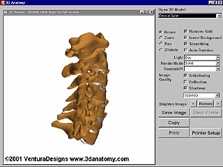 Posture Analysis